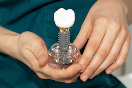 Dentist prosthetist holding a dental implant in his handsの写真素材