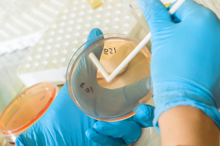 Preparation of cups of Petri for microbiological researches