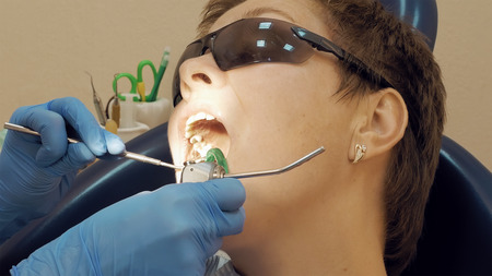 Woman at the dentist clinic office gets dental medical examination and treatment. Close up shot....
