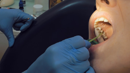 Woman at the dentist clinic office gets dental medical examination and treatment. Close up shot....