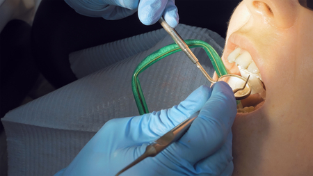 Woman at the dentist clinic office gets dental medical examination and treatment. Close up shot. Odontic and mouth health is important part of modern human life that dentistry help with.の写真素材