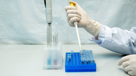 Lab technician scientist performs medical clinic chemical analysis and diagnostics using test tube phial and pipette.の写真素材