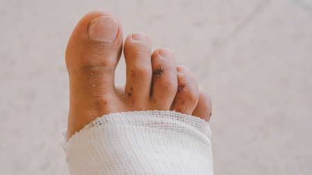 Bandaged leg after abrasion. Protect scratched body parts in travel.の写真素材