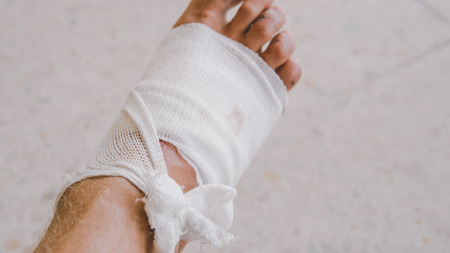 Bandaged leg after abrasion. Protect scratched body parts in travel.の写真素材