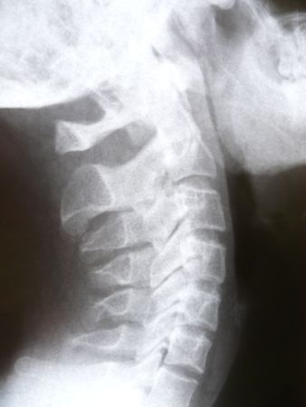  	Neck bone