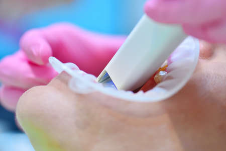 Woman dentist in pink gloves using dental intraoral scanner while examining patient teeth in dental...