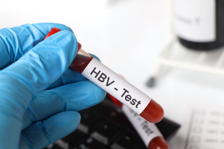 HBV Test to look for abnormalities from blood,  blood sample to analyze in the laboratory, blood in test tubeの写真素材