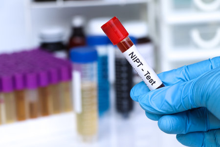 NIPT test to look for abnormalities from blood,  blood sample to analyze in the laboratory, blood in test tubeの写真素材