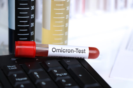 Omicron test to look for abnormalities from blood,  blood sample to analyze in the laboratory, blood in test tubeの写真素材