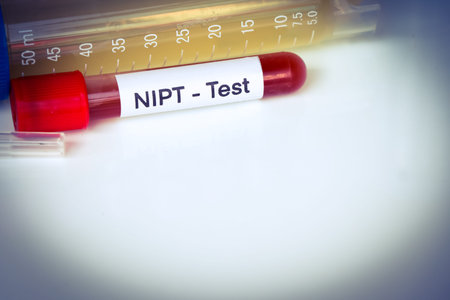 NIPT test to look for abnormalities from blood,  blood sample to analyze in the laboratory, blood in...
