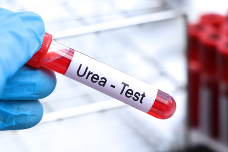Urea test to look for abnormalities from blood,  blood sample to analyze in the laboratory, blood in test tubeの写真素材