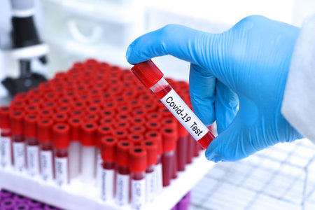 Covid-19 test to look for abnormalities from blood,  blood sample to analyze in the laboratory,...