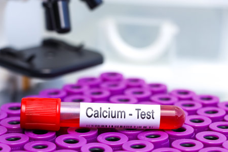 calcium test to look for abnormalities from blood,  blood sample to analyze in the laboratory, blood in test tubeの写真素材