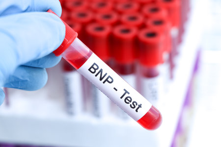 BNP test to look for abnormalities from blood,  blood sample to analyze in the laboratory, blood in test tubeの写真素材
