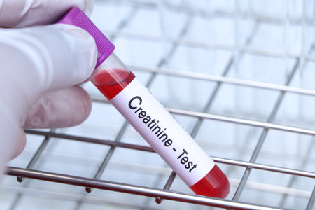 creatinine test to look for abnormalities from blood,  blood sample to analyze in the laboratory,...
