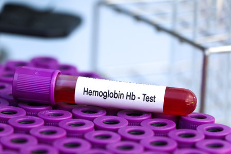 hemoglobin hb test to look for abnormalities from blood,  blood sample to analyze in the laboratory,...
