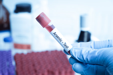 Arsenic test to look for abnormalities from blood,  blood sample to analyze in the laboratory, blood in test tubeの写真素材