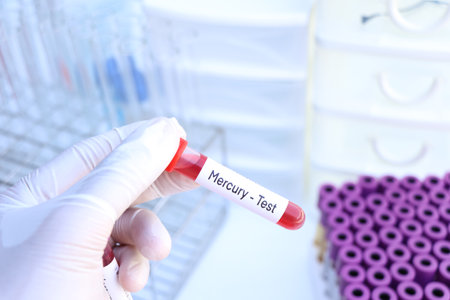 Mercury test to look for abnormalities from blood,  blood sample to analyze in the laboratory, blood in test tubeの写真素材