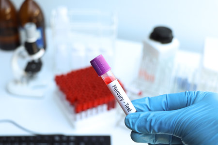 Mercury test to look for abnormalities from blood,  blood sample to analyze in the laboratory, blood in test tubeの写真素材