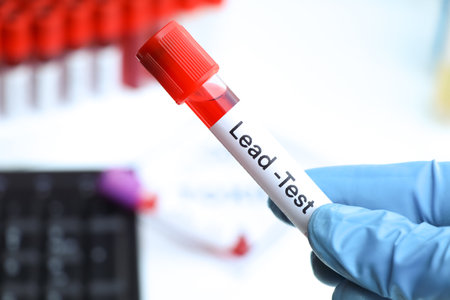 Lead test to look for abnormalities from blood,  blood sample to analyze in the laboratory, blood in test tubeの写真素材