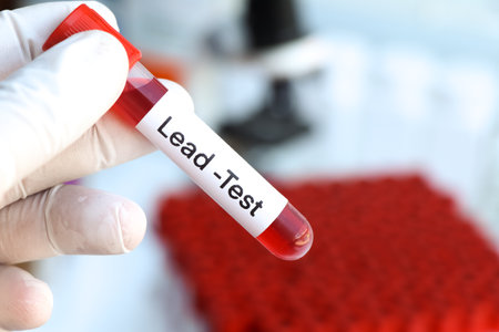 Lead test to look for abnormalities from blood,  blood sample to analyze in the laboratory, blood in test tubeの写真素材