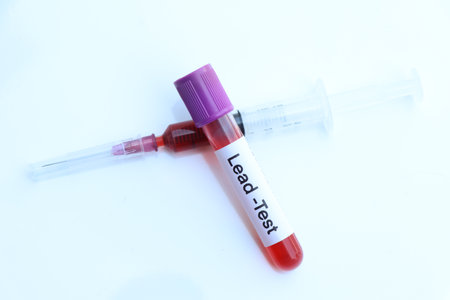 Lead test to look for abnormalities from blood,  blood sample to analyze in the laboratory, blood in test tubeの写真素材