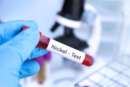 Nickel test to look for abnormalities from blood,  blood sample to analyze in the laboratory, blood...