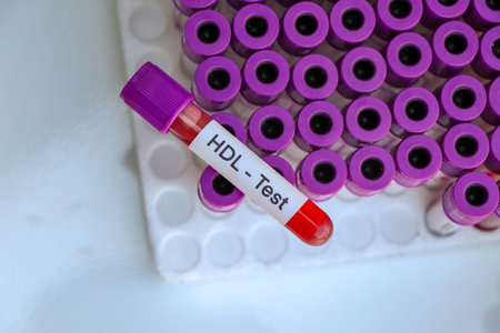 NDL test to look for abnormalities from blood,  blood sample to analyze in the laboratory, blood in test tubeの写真素材