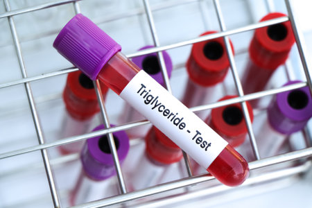 Triglyceride test to look for abnormalities from blood,  blood sample to analyze in the laboratory, blood in test tubeの写真素材
