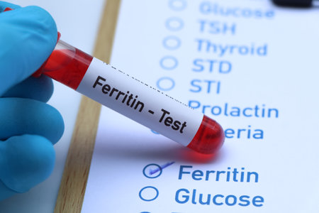 ferritin test to look for abnormalities from blood,  blood sample to analyze in the laboratory, blood in test tubeの写真素材