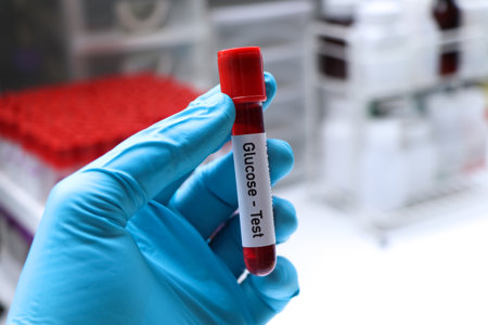 Glucose test to look for abnormalities from blood,  blood sample to analyze in the laboratory, blood in test tubeの写真素材