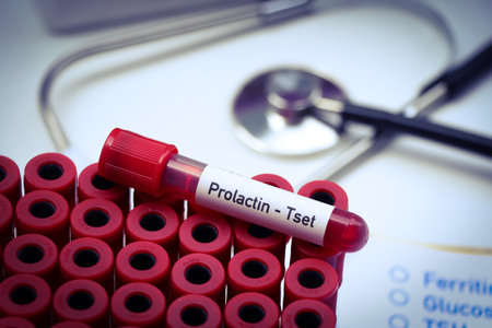 Prolactin test to look for abnormalities from blood,  blood sample to analyze in the laboratory, blood in test tubeの写真素材