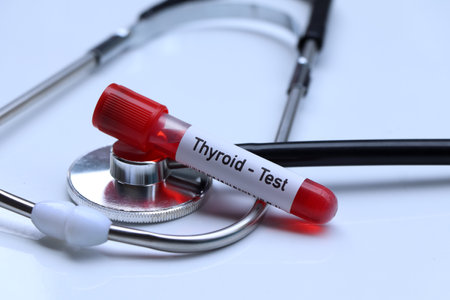 Thyroid test to look for abnormalities from blood,  blood sample to analyze in the laboratory, blood in test tubeの写真素材