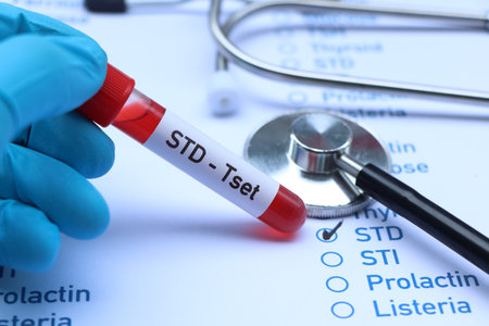 STD test to look for abnormalities from blood,  blood sample to analyze in the laboratory, blood in...