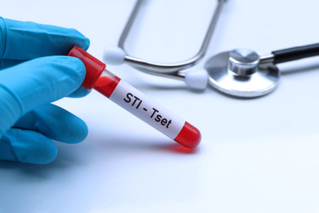 STI test to look for abnormalities from blood,  blood sample to analyze in the laboratory, blood in test tubeの写真素材