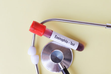Eosinophils test, blood sample to analyze in the laboratory, blood in test tube
