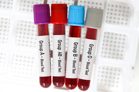 Group blood test, blood sample to analyze in the laboratory, blood in test tubeの写真素材