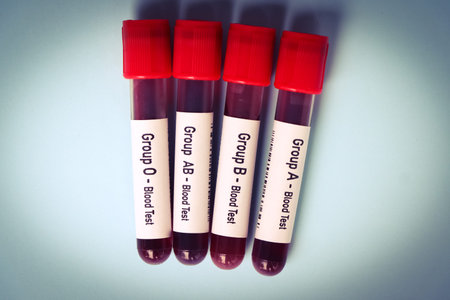 Group blood test, blood sample to analyze in the laboratory, blood in test tube