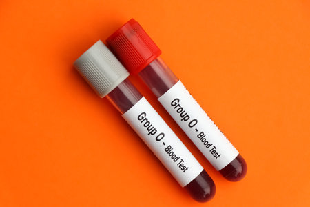 Group 0 - Blood Test, blood sample to analyze in the laboratory, blood in test tubeの写真素材