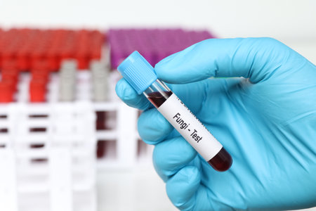 Fungi test, blood sample to analyze in the laboratory, blood in test tubeの写真素材