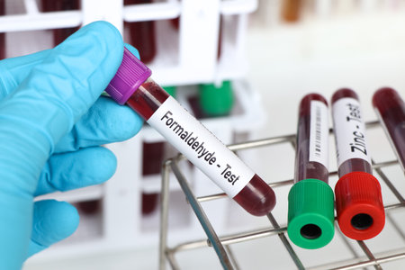 Formaldehyde test, blood sample to analyze in the laboratory, blood in test tubeの写真素材