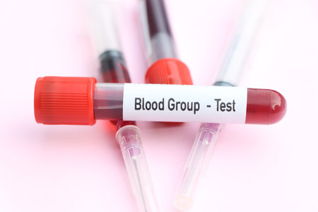 Blood Group test, blood sample to analyze in the laboratory, blood in test tubeの写真素材