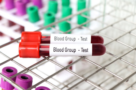 Blood Group test, blood sample to analyze in the laboratory, blood in test tubeの写真素材