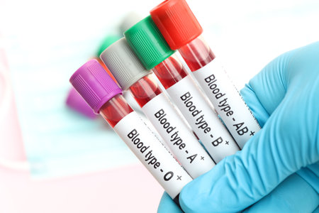 Blood type Rh positive test, blood sample to analyze in the laboratory, blood in test tubeの写真素材