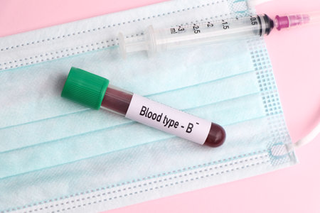 Blood type B Rh negative test, blood sample to analyze in the laboratory, blood in test tubeの写真素材