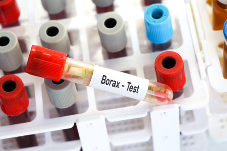 Borax test, food sample to analyze in the laboratory, Food in test tubeの写真素材