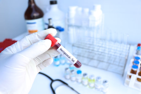 Meningococcal test to look for abnormalities from blood, scientific experiment