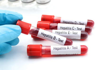 Hepatitis test to look for abnormalities from blood, scientific experimentの写真素材