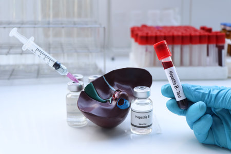Hepatitis B test to look for abnormalities from blood, scientific experiment