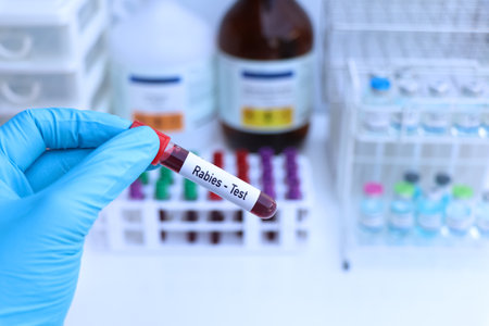 Rabies test to look for abnormalities from blood, scientific experimentの写真素材